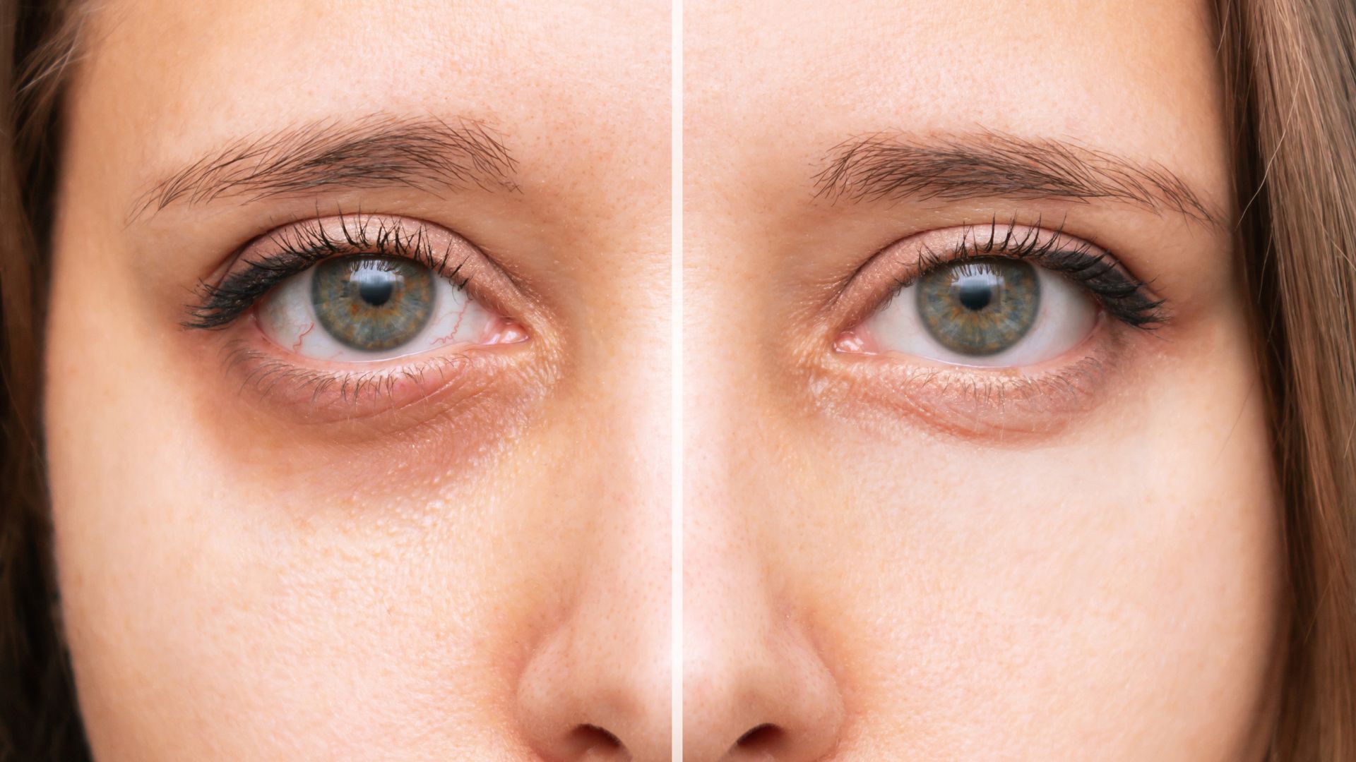 Cernes & contour des yeux