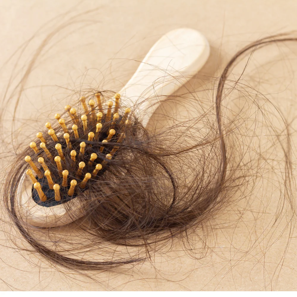 Chute de cheveux